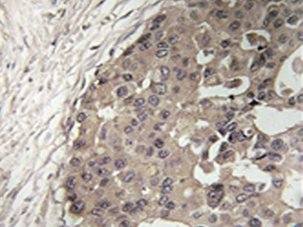 兔抗CSGALNACT1多克隆抗体