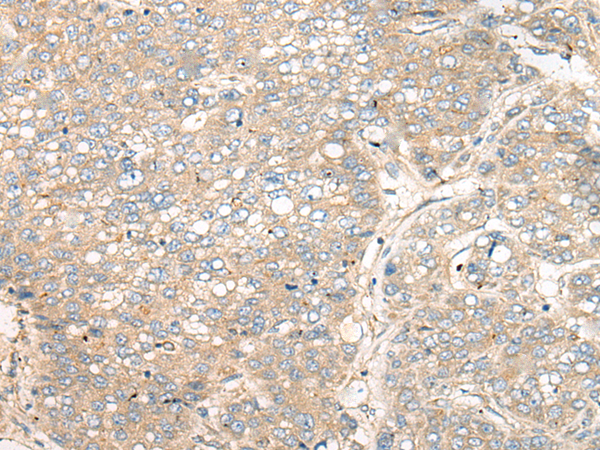 兔抗ZNF449多克隆抗体