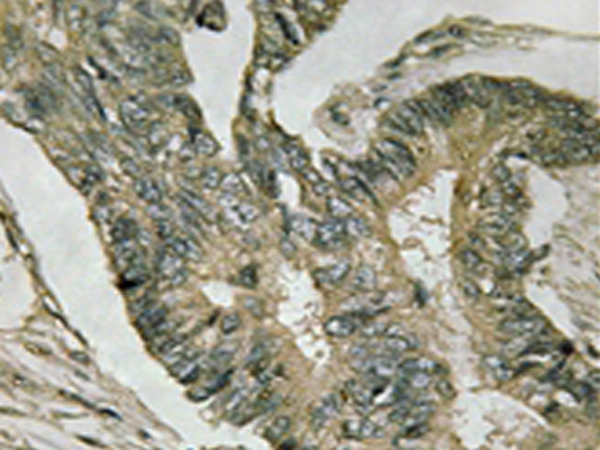 兔抗ALDOC多克隆抗体