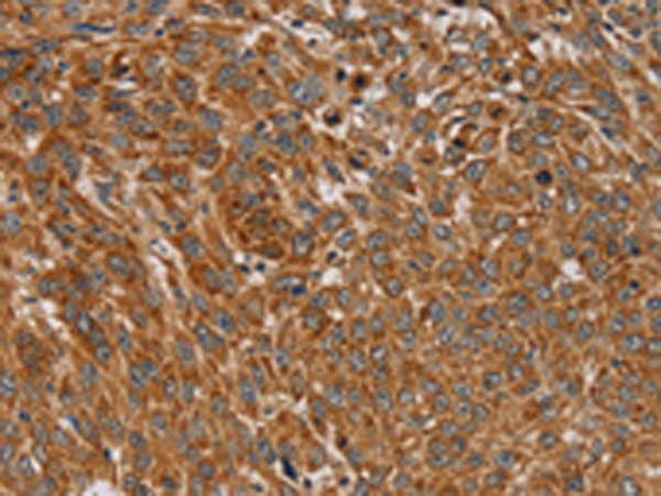 兔抗PLEKHG6多克隆抗体