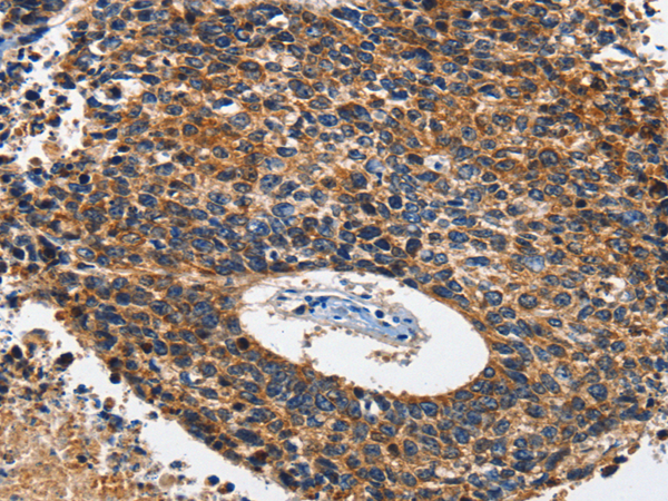 兔抗HK1/HK2多克隆抗体