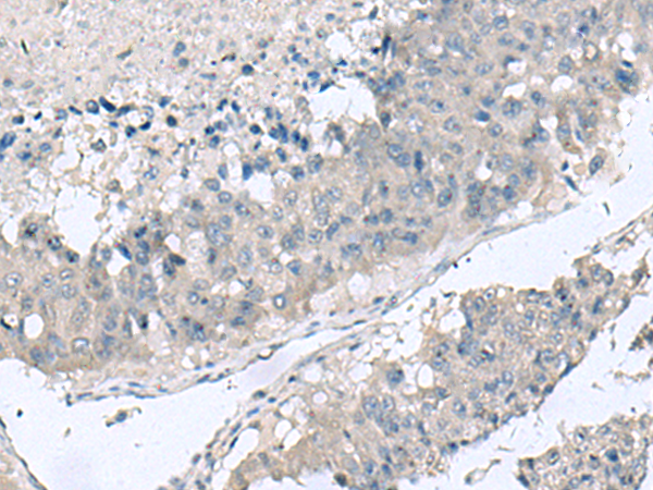 兔抗TNF多克隆抗体