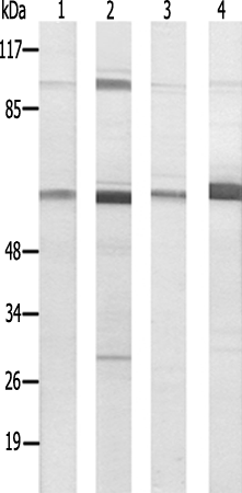 兔抗B3GALTL多克隆抗体
