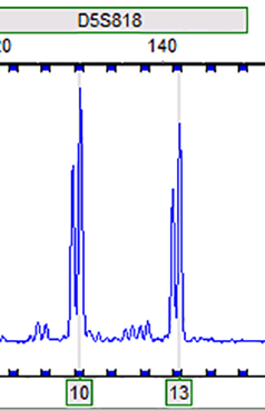 RT112 (人膀胱癌细胞)