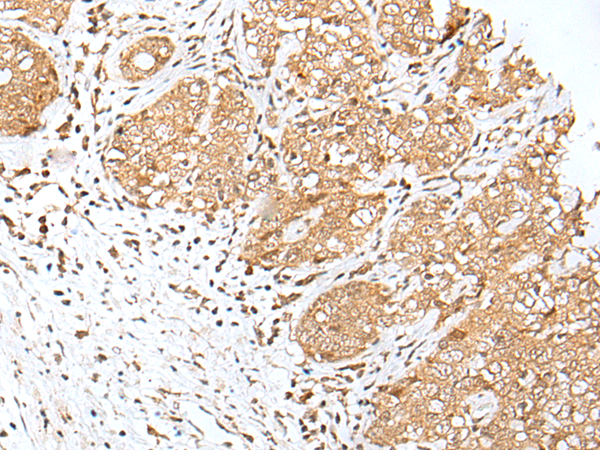 兔抗E2F8多克隆抗体