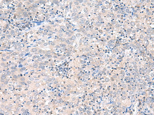 兔抗CLDND1多克隆抗体