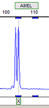 RT112 (人膀胱癌细胞)