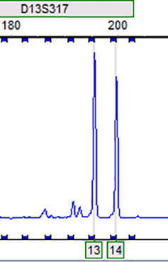 RT112 (人膀胱癌细胞)