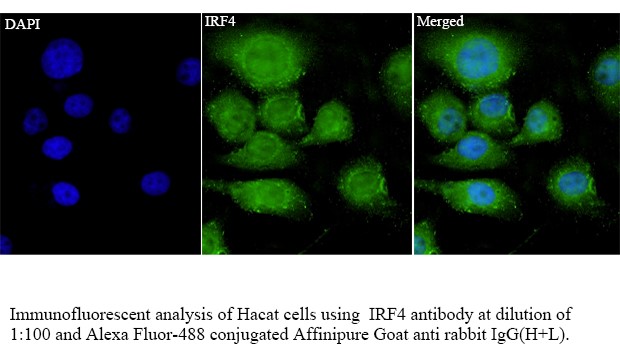 兔单克隆抗体制备(抗体定制服务)
