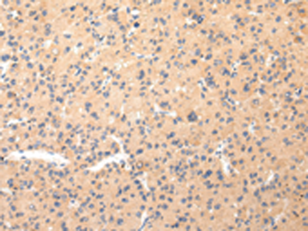 兔抗COL8A2多克隆抗体