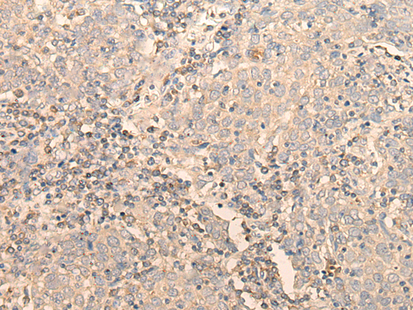 兔抗RPL3多克隆抗体