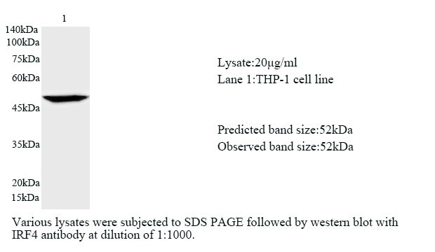兔单克隆抗体制备（抗体定制服务）