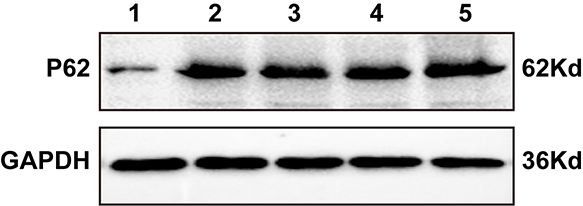 Western Blot