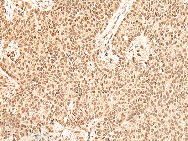 兔抗FBXL4多克隆抗体