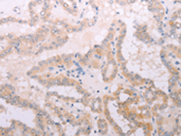 兔抗TPO多克隆抗体