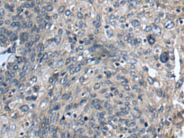 兔抗COG4多克隆抗体