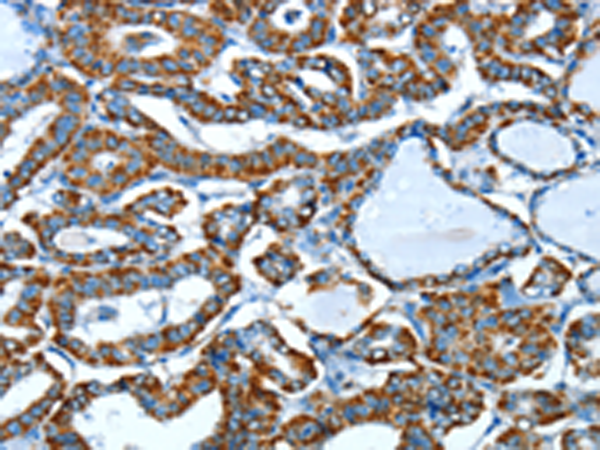 兔抗ALDH6A1多克隆抗体