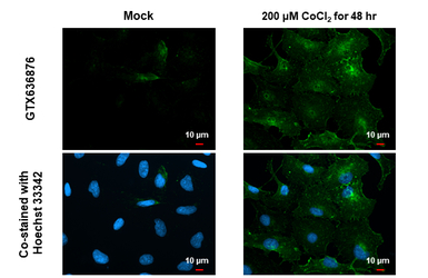 Carbonic Anhydrase IX antibody