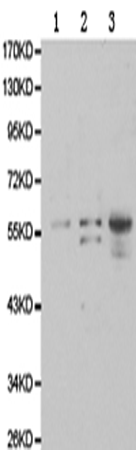 兔抗GSS多克隆抗体