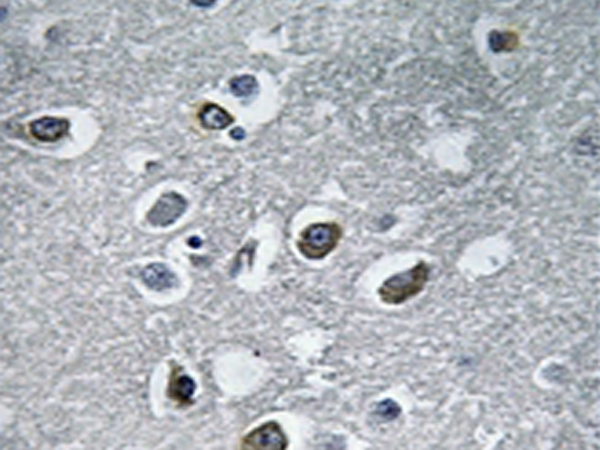 兔抗MARCH4多克隆抗体