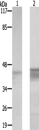 兔抗CXADR多克隆抗体