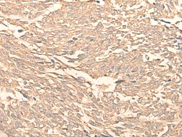 兔抗RPL3多克隆抗体