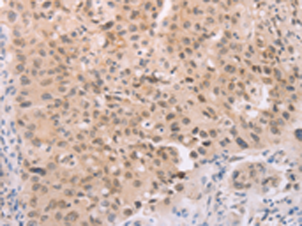 兔抗ADAM11多克隆抗体