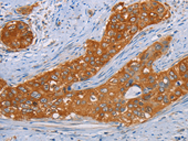 兔抗MMP1多克隆抗体