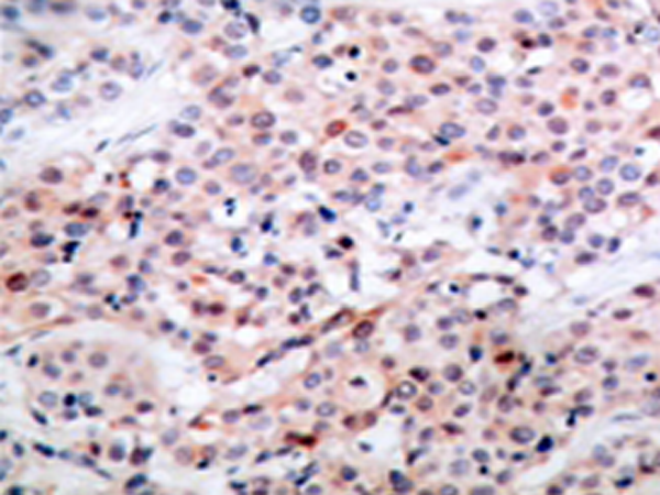 兔抗BCL2(Phospho-Thr56)多克隆抗体