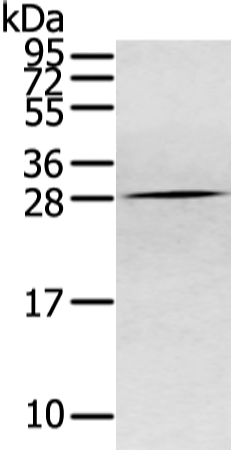 兔抗CLDN15多克隆抗体