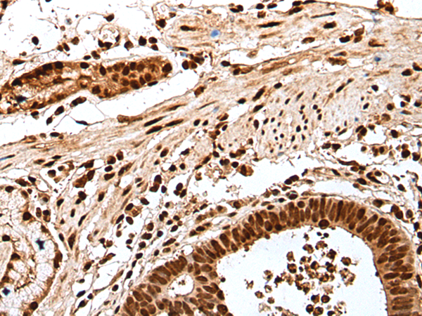兔抗GAR1多克隆抗体