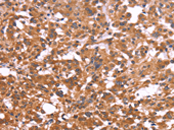 兔抗CRISP3多克隆抗体