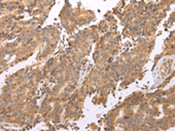 兔抗UQCRC2多克隆抗体