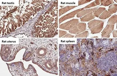 Carbonic Anhydrase IX antibody