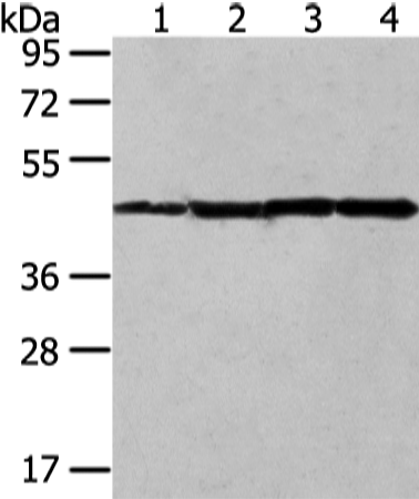 兔抗UQCRC2多克隆抗体