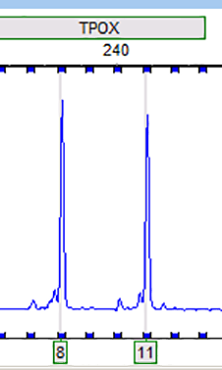 RT112 (人膀胱癌细胞)