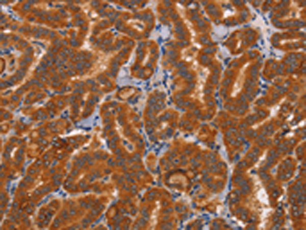 兔抗CTSC多克隆抗体