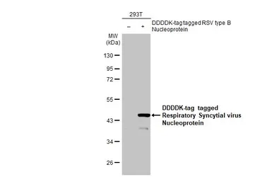 Respiratory Syncytial virus Nu