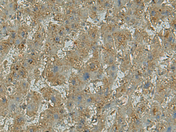 兔抗ALPL多克隆抗体