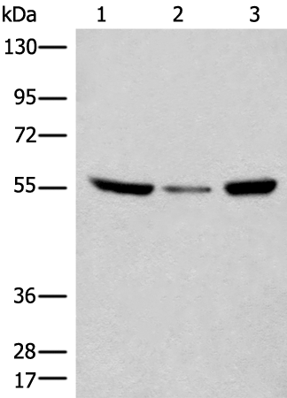 兔抗CCDC102B多克隆抗体