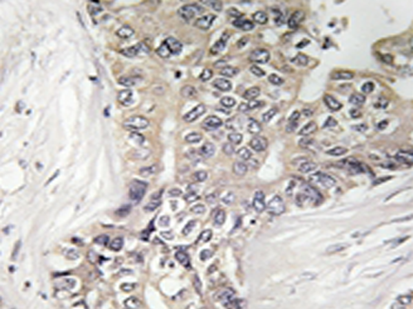 兔抗B3GALTL多克隆抗体