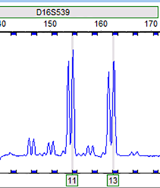 RT112 (人膀胱癌细胞)