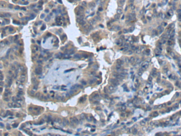 兔抗COG4多克隆抗体