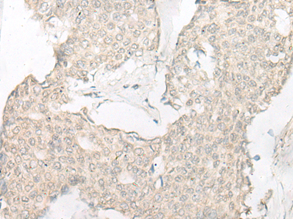 兔抗SLC22A24多克隆抗体