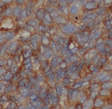 兔多克隆 ANGPTL8 抗体丨anti- ANGPTL8 