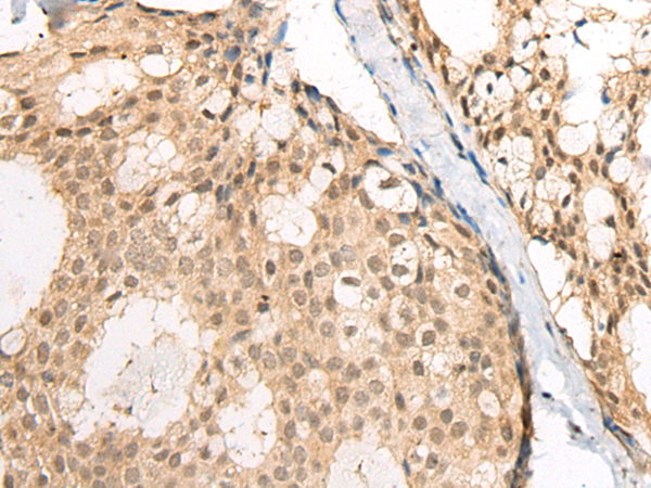 兔抗ZNF449多克隆抗体