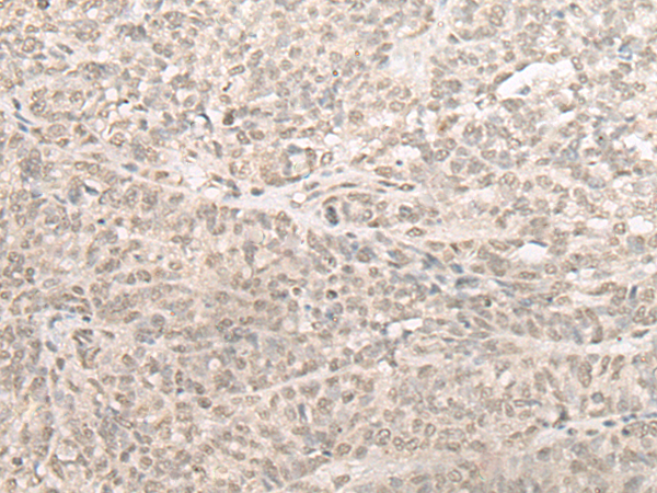 兔抗SLC22A24多克隆抗体