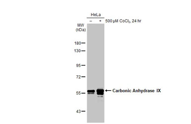 Carbonic Anhydrase IX antibody