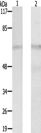 兔抗CSTF2T多克隆抗体