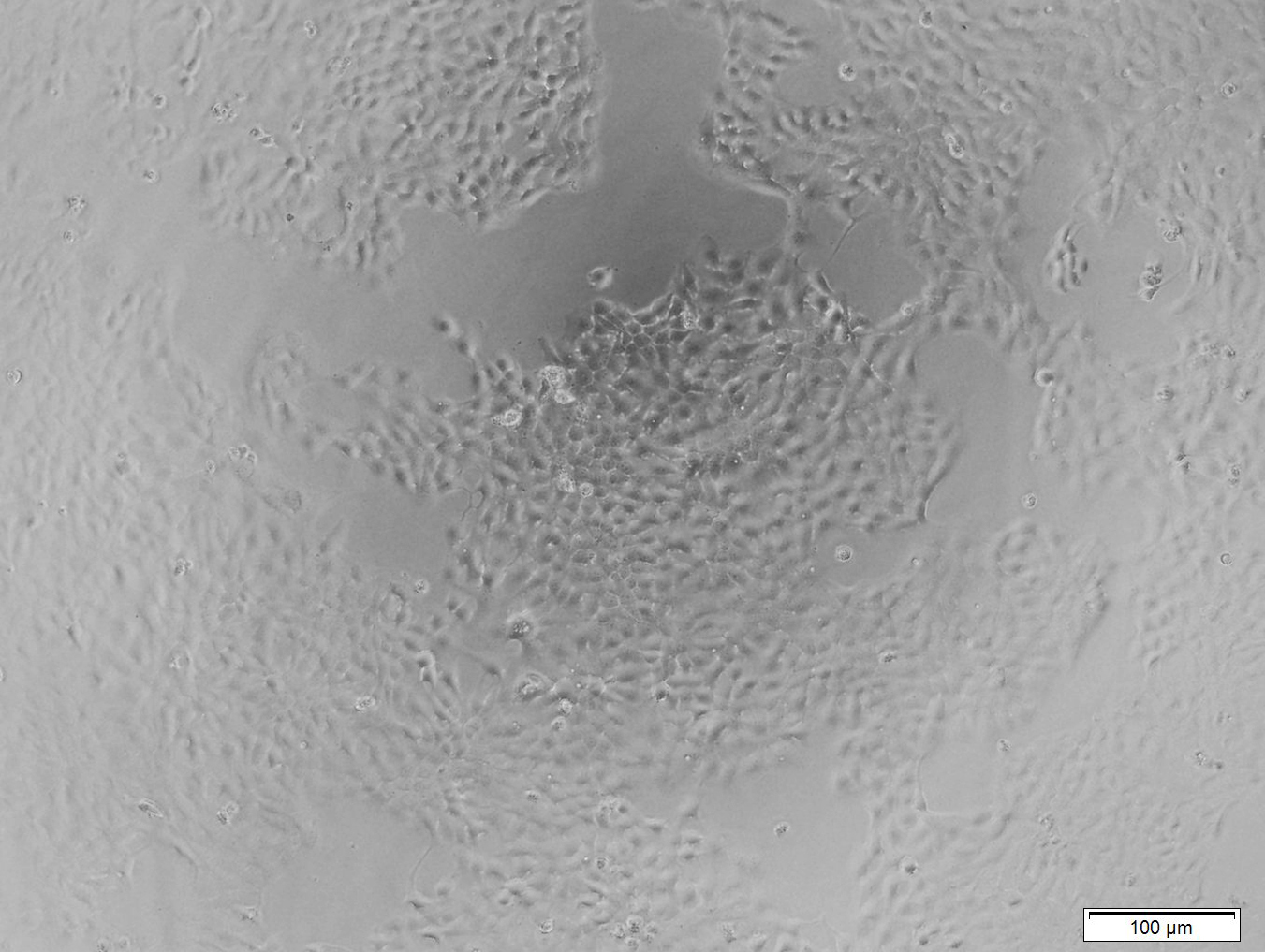 RT112 (人膀胱癌细胞)